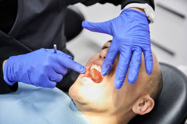 Best Broken or Cracked Tooth Emergency Dentist in Del Rey, CA